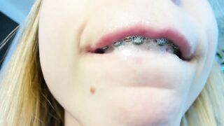 Watch deva_alice New Porn Video [Chaturbate] - new, daddy, lush, teen, braces